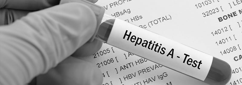 La prueba de la hepatitis A en Clínicas The Test